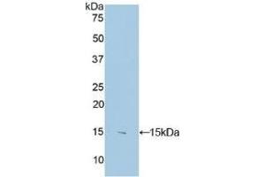 Detection of Recombinant S100B, Human using Polyclonal Antibody to S100 Calcium Binding Protein B (S100B) (S100B Antikörper  (AA 1-92))