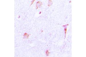 Immunohistochemical analysis of Cathepsin E staining in human brain formalin fixed paraffin embedded tissue section. (Cathepsin E Antikörper  (Center))