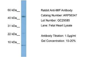 WB Suggested Anti-MIF  Antibody Titration: 0.