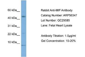 WB Suggested Anti-MIF  Antibody Titration: 0. (MIF Antikörper  (Middle Region))