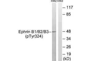 Western blot analysis of extracts from K562 cells treated with serum using Ephrin B1/B2/B3 (Phospho-Tyr324) Antibody. (EFNB1/EFNB2/EFNB3 (pTyr324) Antikörper)