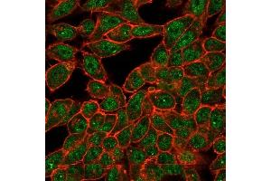 Immunofluorescence (IF) image for anti-CUGBP, Elav-Like Family Member 2 (CELF2) antibody (ABIN7504156)