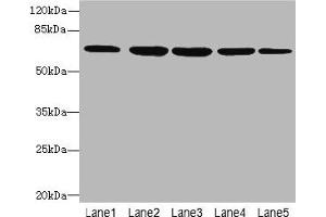 Western blot All lanes: ILVBL antibody at 4 μg/mL Lane 1: HepG2 whole cell lysate Lane 2: Hela whole cell lysate Lane 3: A549 whole cell lysate Lane 4: Jurkat whole cell lysate Lane 5: U87 whole cell lysate Secondary Goat polyclonal to rabbit IgG at 1/10000 dilution Predicted band size: 68 kDa Observed band size: 68 kDa (ILVBL Antikörper  (AA 45-344))