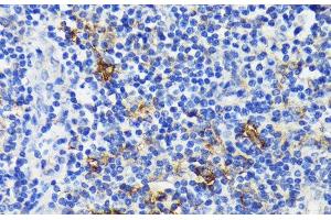 Immunohistochemistry of paraffin-embedded Human tonsil using TREM2 Polyclonal Antibody at dilution of 1:200 (40x lens). (TREM2 Antikörper)