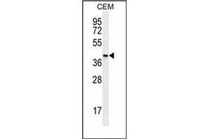Western blot analysis of OGN Antibody (C-term)  in CEM cell line lysates (35ug/lane).