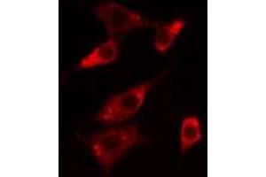 ABIN6276064 staining  Hela cells by IF/ICC.