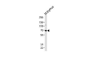 Western blot analysis of lysate from mouse thymus tissue lysate, using Mouse Ephb6 Antibody (Center) (ABIN1881301 and ABIN2838401). (EPH Receptor B6 Antikörper  (AA 503-530))