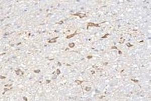 Immunohistochemistry (Paraffin-embedded Sections) (IHC (p)) image for anti-NCK Associated Protein 1 (NCKAP1) antibody (ABIN7074784)