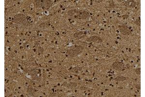ABIN6278641 at 1/100 staining Rat brain tissue by IHC-P. (T-Box 15/18 Antikörper)