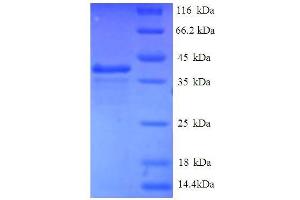 SDS-PAGE (SDS) image for Eukaryotic Translation Initiation Factor 1 (EIF1) (AA 1-113), (full length) protein (GST tag) (ABIN1046987)