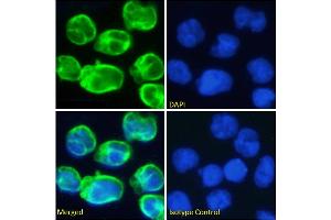 Immunofluorescence staining of fixed Molt4 cells with anti-CD3 epsilon antibody OKT-3. (Rekombinanter CD3E (Muromonab Biosimilar) Antikörper)