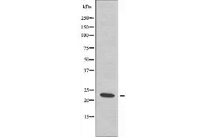 Western blot analysis of extracts from COLO205 cells, using RPS5 antibody. (RPS5 Antikörper  (Internal Region))