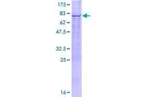 TBC1D2 Protein (AA 1-502) (GST tag)