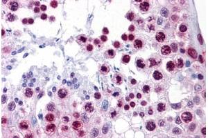 Human Testis: Formalin-Fixed, Paraffin-Embedded (FFPE) (HMGB1 Antikörper  (AA 1-91))
