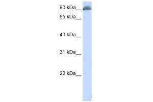 EPB41 antibody used at 1 ug/ml to detect target protein. (EPB41 Antikörper  (N-Term))