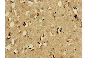Immunohistochemistry of paraffin-embedded human brain tissue using ABIN7171209 at dilution of 1:100 (SNCAIP Antikörper  (AA 309-553))