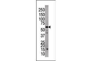 Western blot analysis of anti-P3CC Pab (ABIN392896 and ABIN2837998) in A375cell line lysate. (PPP3CC Antikörper  (C-Term))