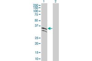 Western Blotting (WB) image for SERPINC1 293T Cell Transient Overexpression Lysate(Denatured) (ABIN1330998)