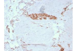 Formalin-fixed, paraffin-embedded human Colon stained with Fodrin Mouse Monoclonal Antibody (SPTAN1/3351).