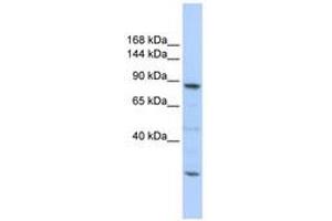 Image no. 1 for anti-CDC5 Cell Division Cycle 5-Like (S. Pombe) (CDC5L) (C-Term) antibody (ABIN6740663) (CDC5L Antikörper  (C-Term))
