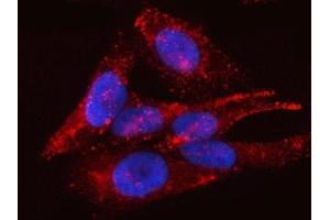 IF analysis of PTRF/CAVIN1 using anti-PTRF/CAVIN1 antibody (ABIN7601817).