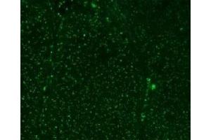 Immunofluorescent testing of colon carcinoma with Alexa Fluor 488 conjugated Nucleoli marker antibody. (Nucleoli Marker Antikörper)