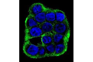 Confocal immunofluorescent analysis of CLCN7 Antibody (C-term) (ABIN655808 and ABIN2845235) with WiDr cell followed by Alexa Fluor 488-conjugated goat anti-rabbit lgG (green). (CLCN7 Antikörper  (C-Term))