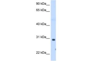 Western Blotting (WB) image for anti-ST3 beta-Galactoside alpha-2,3-Sialyltransferase 3 (ST3GAL3) antibody (ABIN2463000) (ST3GAL3 Antikörper)