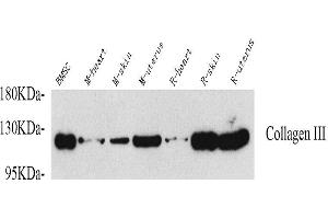 Western Blot analysis of various samples using COL3A1 Polyclonal Antibody at dilution of 1:750. (COL3A1 Antikörper)