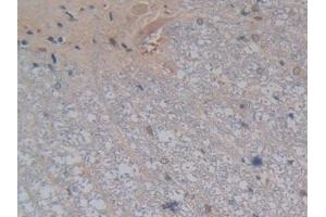 DAB staining on IHC-P; Samples: Rat Spinal cord Tissue