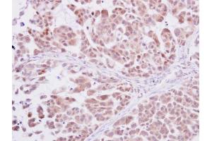 Immunohistochemistry (IHC) image for anti-Polymerase (DNA Directed), delta 1, Catalytic Subunit 125kDa (POLD1) (Center) antibody (ABIN2855506)