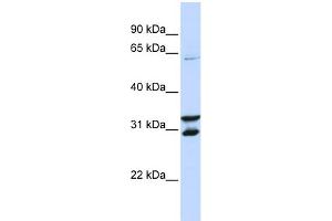 WB Suggested Anti-FBXO24 Antibody Titration:  0. (FBXO24 Antikörper  (N-Term))