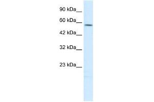 TPH2 antibody used at 1 ug/ml to detect target protein. (Tryptophan Hydroxylase 2 Antikörper  (N-Term))