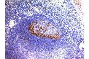 Formalin-fixed, paraffin-embedded human Tonsil stained with PD1 (CD279) Monoclonal Antibody (SPM597). (PD-1 Antikörper)