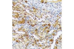 Immunohistochemistry of paraffin-embedded rat ovary using CF antibody (3087) at dilution of 1:100 (40x lens). (A1CF Antikörper  (AA 50-120))