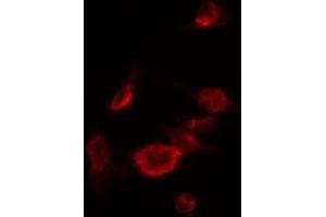 ABIN6276033 staining A549 by IF/ICC. (GPR32 Antikörper  (Internal Region))