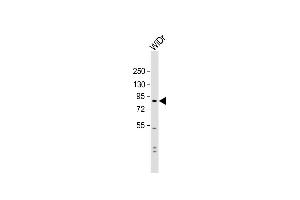 Anti-SUSD2 Antibody (C-term) at 1:1000 dilution + WiDr whole cell lysate Lysates/proteins at 20 μg per lane.