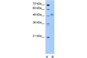 Western Blotting (WB) image for anti-Zona Pellucida Glycoprotein 4 (ZP4) antibody (ABIN2463282)
