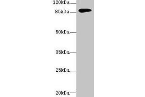 Western blot All lanes: DGKG antibody at 4 μg/mL + Mouse brain tissue Secondary Goat polyclonal to rabbit IgG at 1/10000 dilution Predicted band size: 90, 87, 85 kDa Observed band size: 90 kDa (DGKG Antikörper  (AA 1-255))