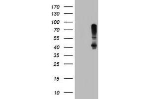 Image no. 1 for anti-serpin Peptidase Inhibitor, Clade B (Ovalbumin), Member 1 (SERPINB1) (AA 77-306) antibody (ABIN1491670) (SERPINB1 Antikörper  (AA 77-306))