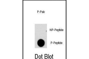 Dot blot analysis of anti-NFATC2-p Phospho-specific Pab (ABIN389814 and ABIN2839702) on nitrocellulose membrane. (NFAT1 Antikörper  (pSer330))