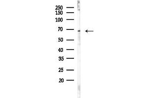 Western blot analysis of lysates from 293 cells, using PIAS2 Antibody at 1/1000 dilution.
