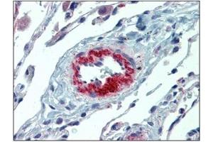 Immunohistochemistry (IHC) image for anti-Interleukin 23, alpha subunit p19 (IL23A) antibody (ABIN614363) (IL23A Antikörper)