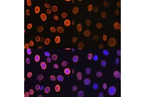 Immunofluorescence (IF) image for anti-Histone H4 (acLys5) antibody (ABIN7267743)