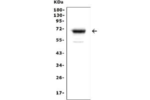 Western blot analysis of Mesothelin using anti-Mesothelin antibody (ABIN3043459).