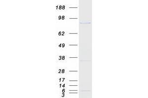 Western Blotting (WB) image for Regulatory Factor X 3 (RFX3) (Transcript Variant 2) protein (Myc-DYKDDDDK Tag) (ABIN2730795)