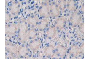 IHC-P analysis of Mouse Kidney Tissue, with DAB staining. (NEXN Antikörper  (AA 421-607))