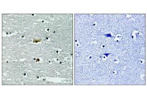 Immunohistochemical analysis of paraffin-embedded human brain tissue using STK39 (Phospho-Ser309) antibody (left)or the same antibody preincubated with blocking peptide (right). (STK39 Antikörper  (pSer311))