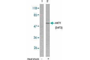Western blot analysis of extracts from HeLa cells untreated or treated with heat shock using AKT1 (phospho S473) polyclonal antibody . (AKT1 Antikörper  (pSer473))