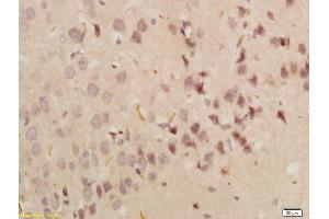 Formalin-fixed and paraffin embedded rat brain labeled with Anti-GRP78 Polyclonal Antibody, Unconjugated (ABIN673554) followed by conjugation to the secondary antibody and DAB staining (GRP78 Antikörper  (AA 251-360))